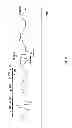 Fig. 03 - Metrics of electrical dyssynchrony and electrical activation patterns from surface ECG electrodes