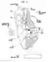 Fig. 09 - Sound processor accessory