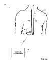 Fig. 02 - Automated programming of electrical stimulation electrodes using post-implant imaging