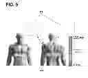 Fig. 07 - Implantable electrode location selection