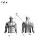 Fig. 08 - Implantable electrode location selection