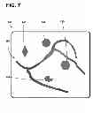 Fig. 09 - Implantable electrode location selection
