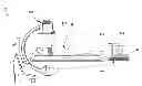 Fig. 01 - Implantable electrode location selection
