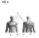 Fig. 08 - Implantable electrode location selection