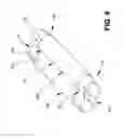 Fig. 07 - EXPANDABLE SUPPORTIVE ENDOLUMINAL STENT GRAFT