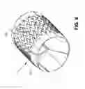 Fig. 09 - EXPANDABLE SUPPORTIVE ENDOLUMINAL STENT GRAFT