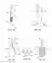 Fig. 02 - Delivery system with pacing element