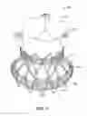 Fig. 09 - Delivery system with pacing element