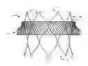 Fig. 01 - TRANSCATHETER MITRAL VALVE AND DELIVERY SYSTEM