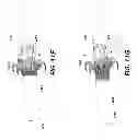 Fig. 20 - TRANSCATHETER MITRAL VALVE AND DELIVERY SYSTEM