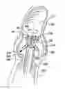 Fig. 01 - Valve suturing and implantation procedures