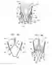 Fig. 02 - Valve suturing and implantation procedures