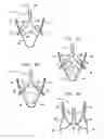 Fig. 04 - Valve suturing and implantation procedures