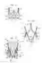 Fig. 05 - Valve suturing and implantation procedures