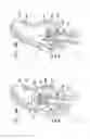 Fig. 13 - Valve suturing and implantation procedures