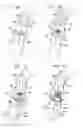 Fig. 17 - Valve suturing and implantation procedures