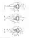 Fig. 28 - Valve suturing and implantation procedures