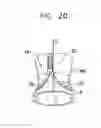 Fig. 35 - Valve suturing and implantation procedures