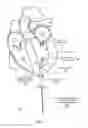 Fig. 43 - Mitral valve spacer and system and method for implanting the same