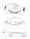 Fig. 02 - SCLERAL FIXATION BAG