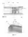 Fig. 06 - Medical device comprising an artificial contractile structure