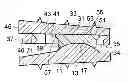 Fig. 01 - INTERVERTEBRAL DISC