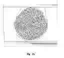 Fig. 04 - Metallic structures having porous regions from imaged bone at pre-defined anatomic locations
