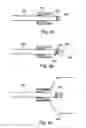 Fig. 04 - Prosthetic devices and methods for using same