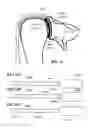 Fig. 09 - Prosthetic devices and methods for using same