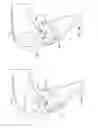 Fig. 04 - Posterior stabilized insert trial with adjustable post