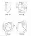 Fig. 02 - Talonavicular joint prosthesis and its method of implantation
