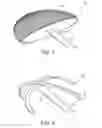 Fig. 07 - Talonavicular joint prosthesis and its method of implantation