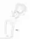 Fig. 02 - Modular Joint Prosthesis System, Premounted Joint Prosthesis System Part and Sterile Article