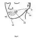 Fig. 07 - METHOD AND SYSTEM FOR ACQUIRING DATA FROM AN INDIVIDUAL FOR PREPARING A 3D MODEL