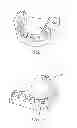 Fig. 02 - Method and system for making a dental restoration
