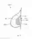 Fig. 07 - Method of Forming a Prosthesis
