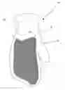 Fig. 01 - GLOVE WITH MOISTURE ABOSRBENT APPLICATOR LAYER