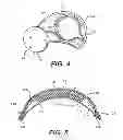 Fig. 04 - Protective element for use in sport