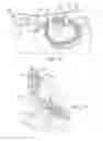 Fig. 07 - Clip