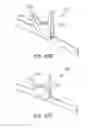 Fig. 14 - Combination square with swivel head