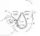 Fig. 01 - DEVICE FOR FITTING AND DETERMINING THE SIZE OF A PATIENT INTERFACE