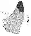 Fig. 13 - Braided Upper With Overlays For Article Of Footwear