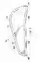 Fig. 07 - BAKING PAN WITH TAB AND ASSOCIATED TOOL