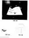 Fig. 06 - Medical tubes and methods of manufacture