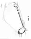 Fig. 02 - Method of controlling uterine hemorrhage