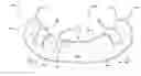 Fig. 01 - Dental appliance