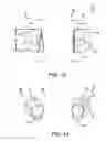 Fig. 09 - Dental appliance