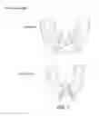 Fig. 08 - Mouthguard