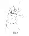 Fig. 04 - Cleaning apparatus
