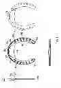 Fig. 02 - Horseshoe with splaying, and stabilizer feature